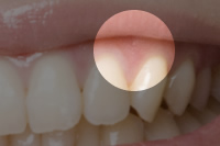 ピンクエステティック