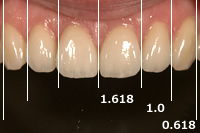 前歯のバランス比率