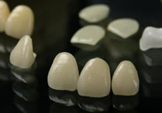Porcelain Fillings and Crowns