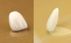 ラミネートベニア