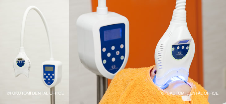 オフィスホワイトニング